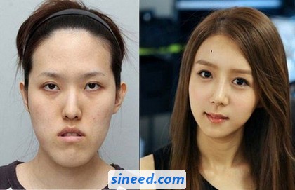 new-face-of-korean-women-01.jpg