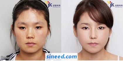 new-face-of-korean-women-03.jpg